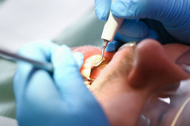 Best Dentist for Tooth Abscess  in New Richmond, OH