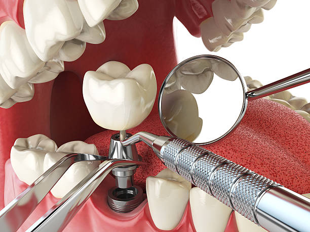 Best Urgent Tooth Repair  in New Richmond, OH